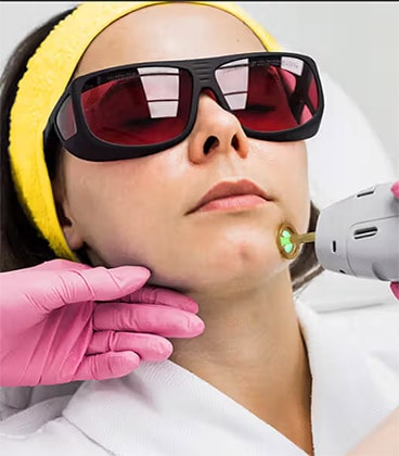 لیزر موهای زائد